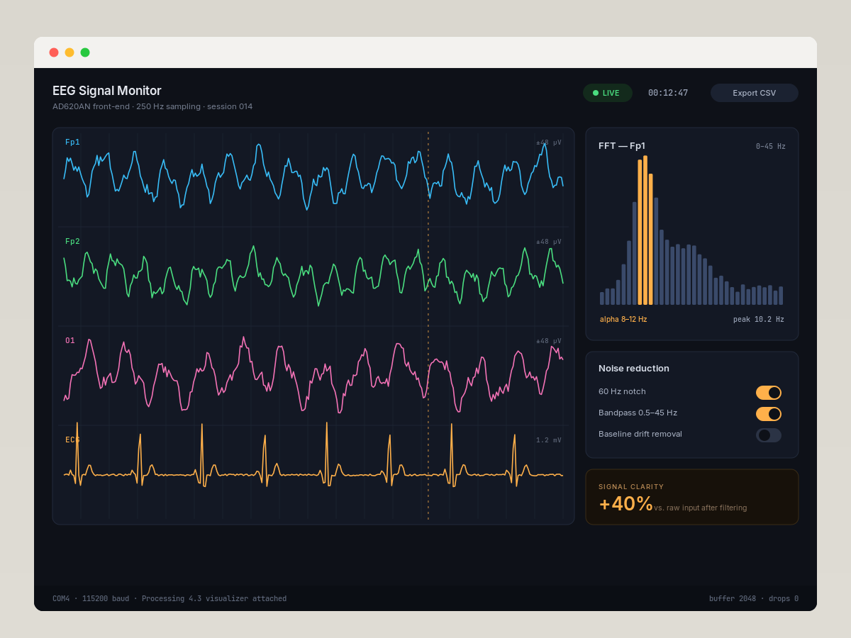 EEG signal-processing circuit